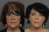 Facelift