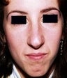 28 year old female patient 