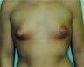 24 year old female patient 
