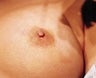 23 year old female patient 
