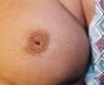 23 year old female patient 