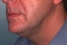 55 year old male patient 