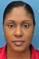 African American Rhinoplasty