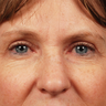 50 - 60 Year Old Female