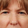 50 - 60 Year Old Female