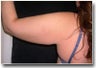 Arm