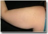 Arm