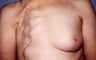62 year old female patient 