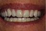 Dental Makeover