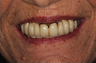 Dental Makeover
