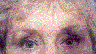Eyebrow descent in middle ae