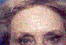 Eyebrow descent in middle ae