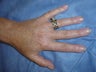 Hand Veins