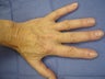 Hand Veins