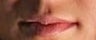 Lip Enhancement