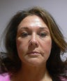 49 year old woman has Mini Facelift