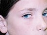 15 year old female patient 