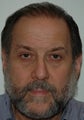 Hair transplant