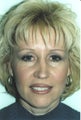 Brow lift
