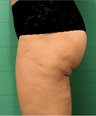 Exilis