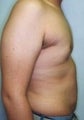 19 year old male patient 