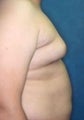 19 year old male patient 