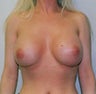 41 year old female patient 