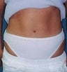 34 year old female patient 