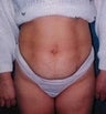 34 year old female patient 