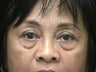 64 year old female complains of her "bags"