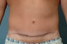 Age: 17, Height: 6"2", Weight: 241lbs. 