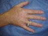 Hand Veins