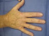 Hand Veins
