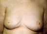 78 year old female patient 