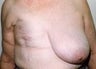 78 year old female patient 