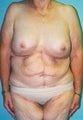 50 year old female patient 