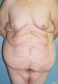 50 year old female patient 