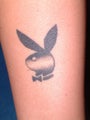 Tattoo Removal
