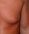 23 year old female patient 