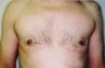 37 year old male patient 