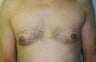 37 year old male patient 