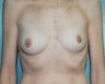 34 year old female patient 