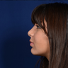 Chin Surgery
