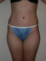 38 year old female patient 