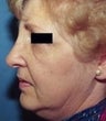 64 year old female patient 
