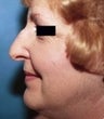 64 year old female patient 