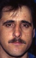 Revision Rhinoplasty