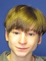 Young male treated for prominent ears with Otoplasty ("Ear Pinning")