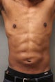 42 Year Male Treated to Increase Ab Definition 