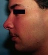 26 year old male patient 